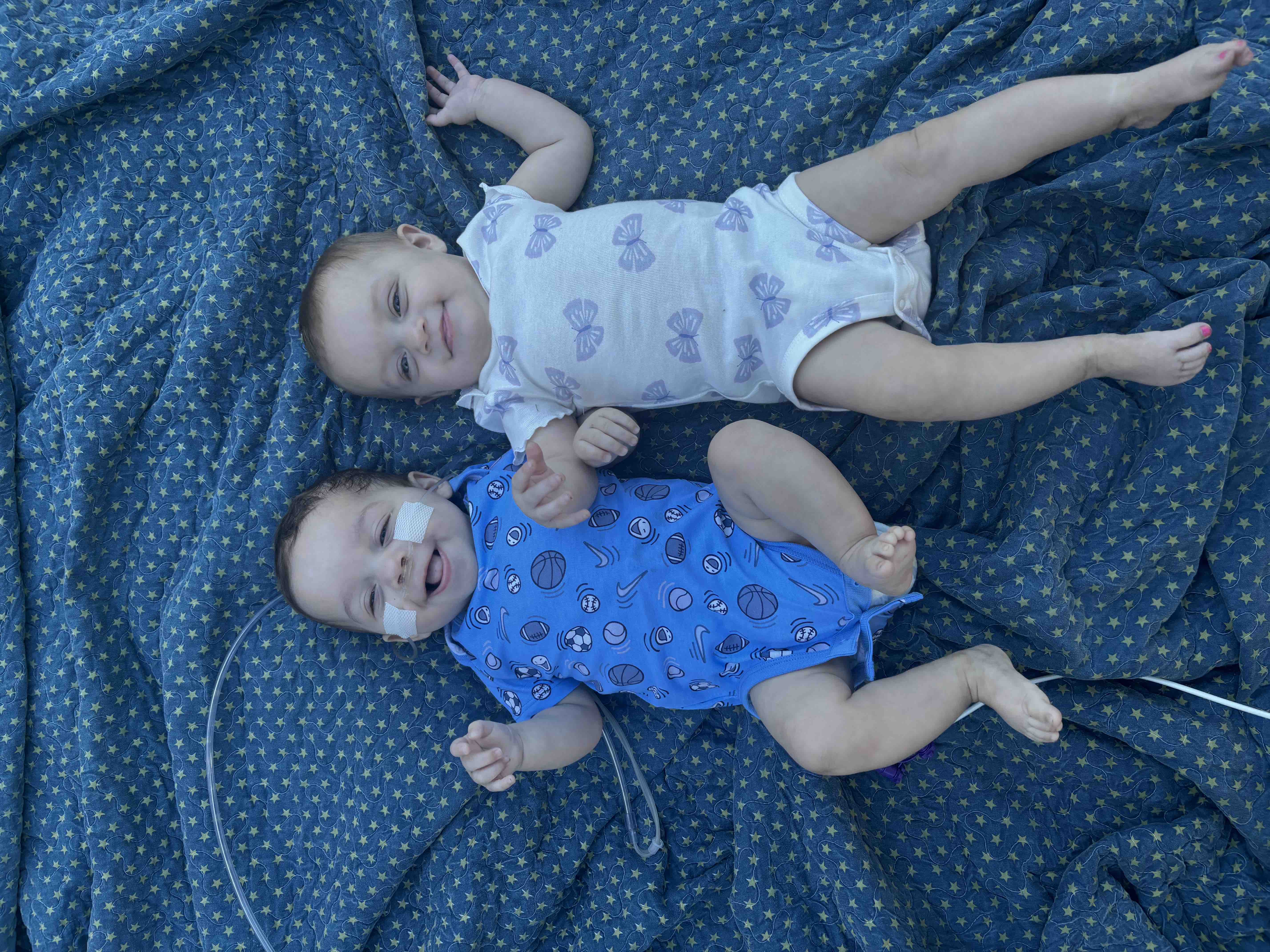 Help baby Liam fight lifelong medical issues! — photo 3