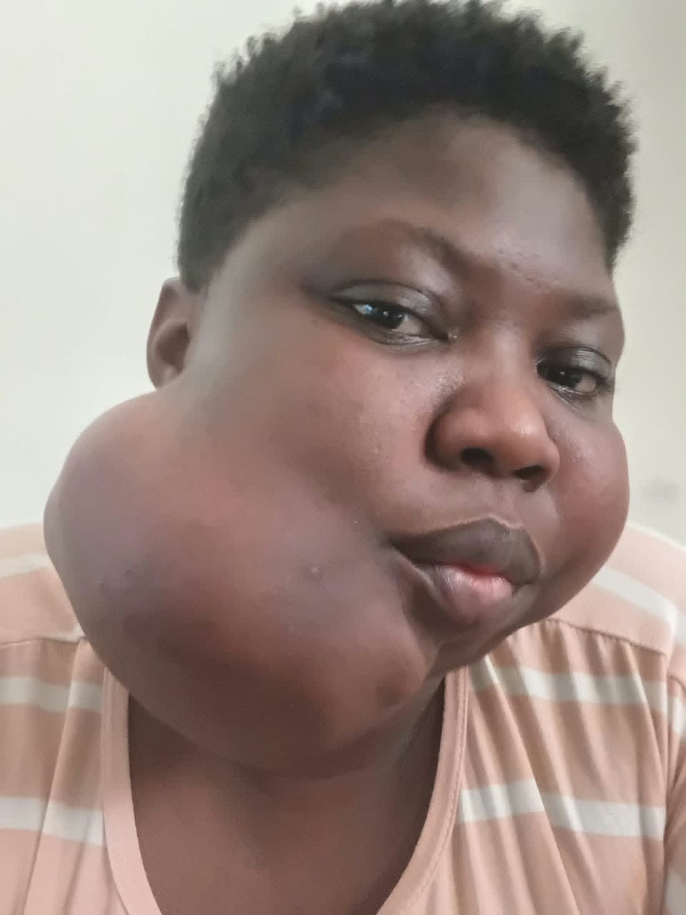 Help Joyce access urgent surgery for a severe jaw tumour β photo 3