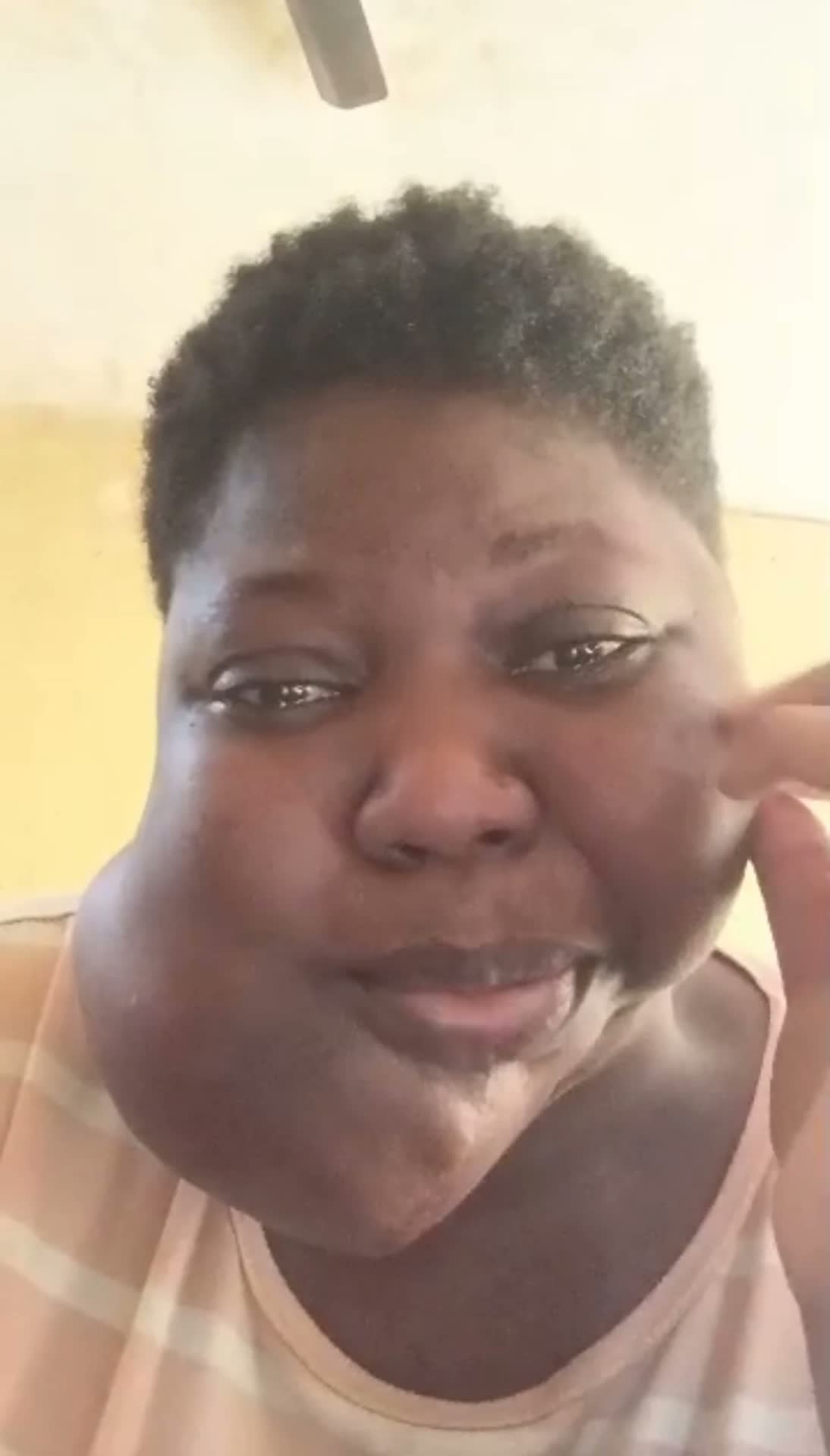 Help Joyce access urgent surgery for a severe jaw tumour β photo 4