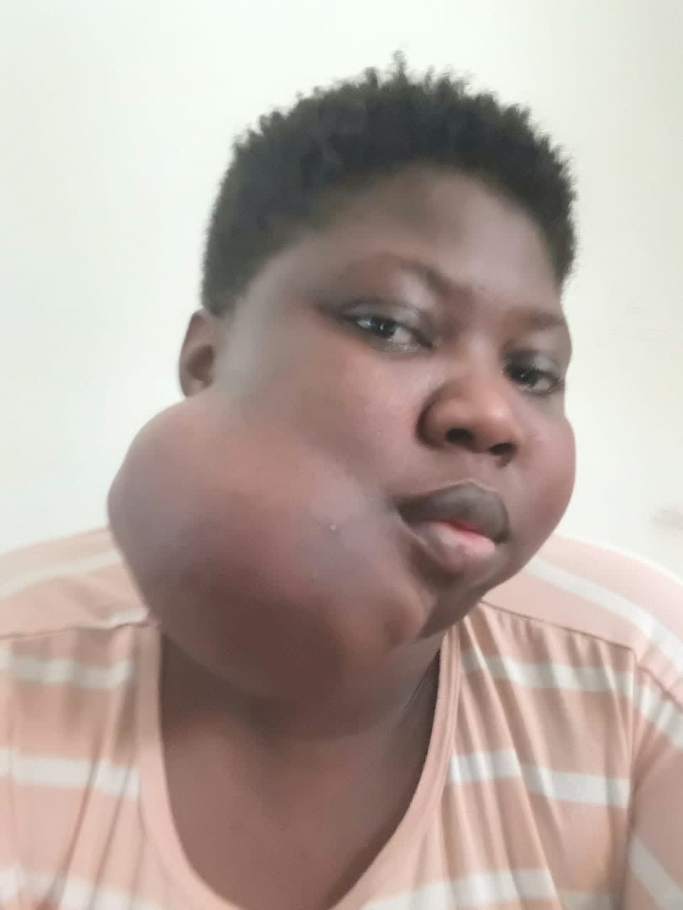 Help Joyce access urgent surgery for a severe jaw tumour β photo 5